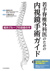 若手脊椎外科医のための内視鏡手術ガイド | 神陵文庫