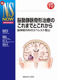 新NS NOW 10 脳動静脈奇形治療のこれまでとこれから | 神陵文庫