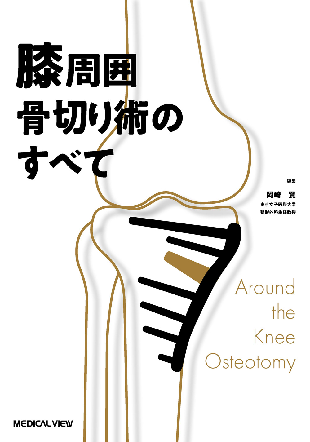 膝周囲骨切り術のすべて | 神陵文庫