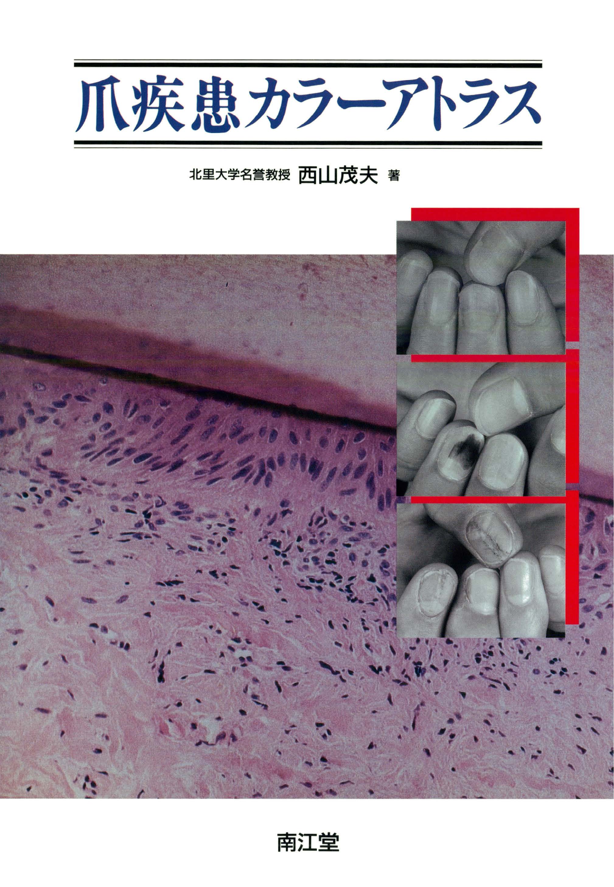 爪疾患カラーアトラス | 神陵文庫