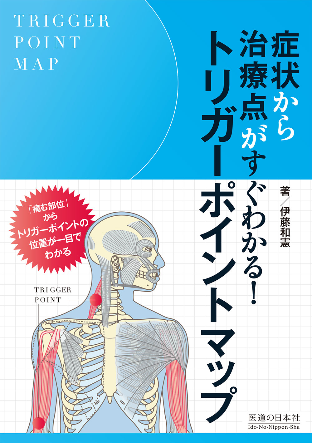 症状から治療点がすぐわかる！トリガーポイントマップ | 神陵文庫