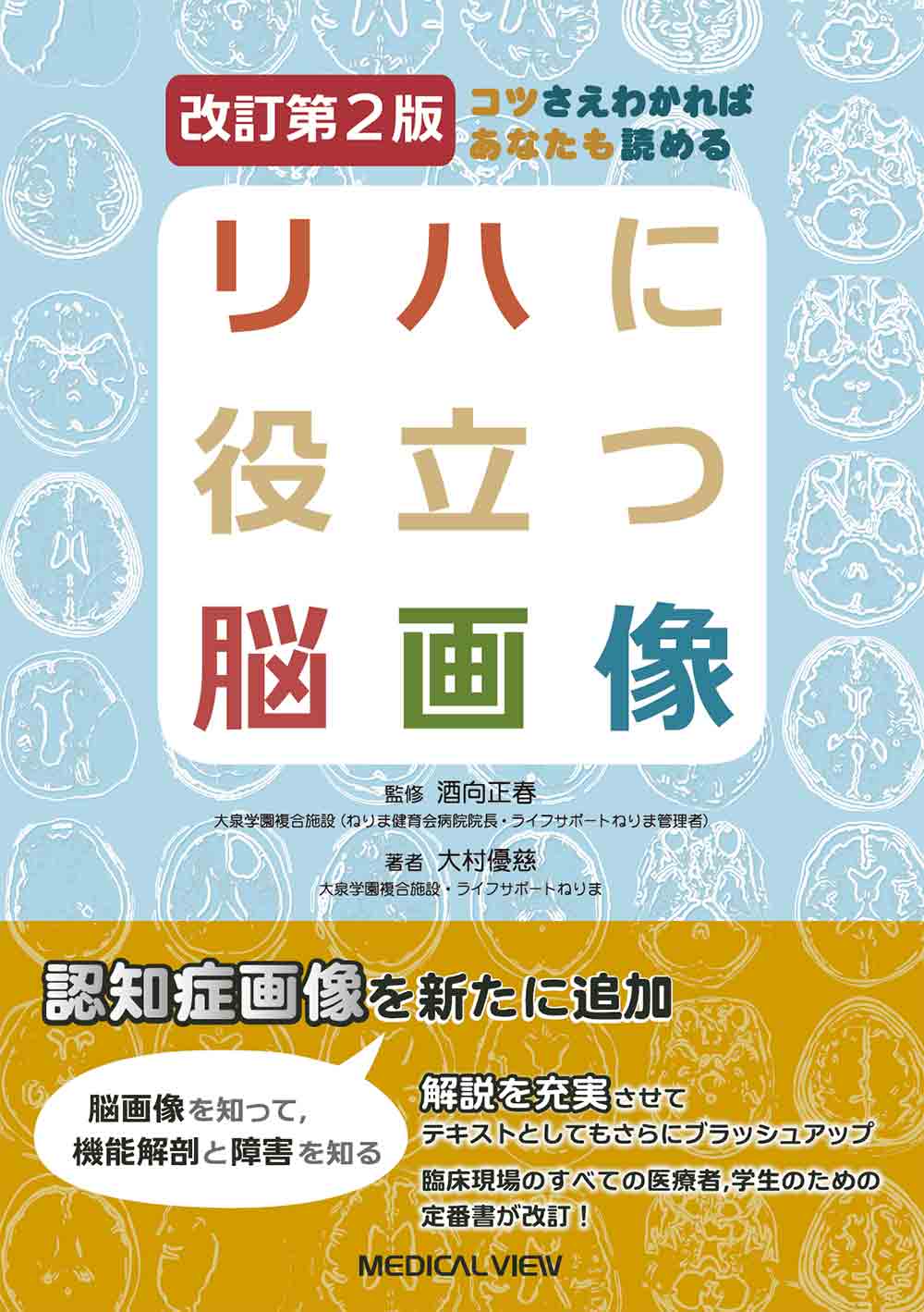 リハに役立つ脳画像 改訂第2版 | 神陵文庫
