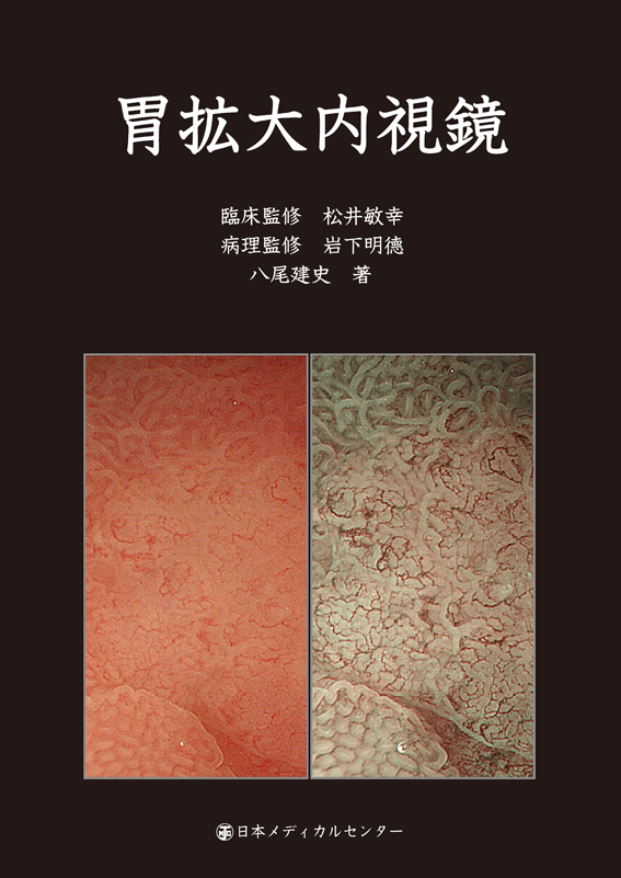 胃拡大内視鏡 八尾建史 著 日本メディカルセンター 胃拡大内視鏡【電子版】 | 神陵文庫