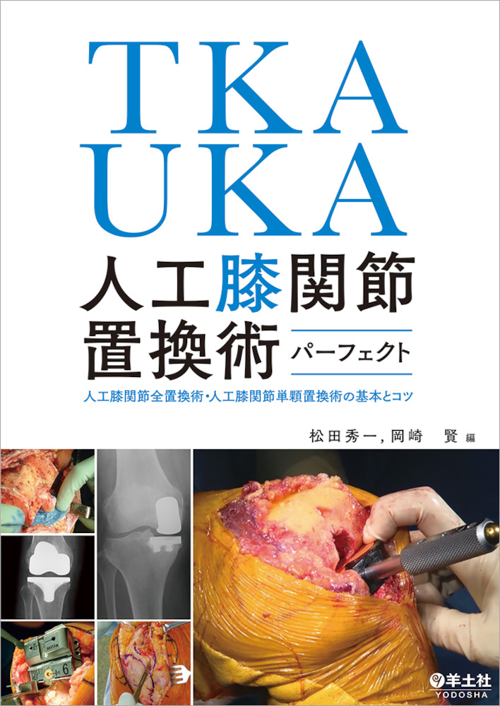 人工膝関節置換術 TKA・UKA 人工膝関節置換術パーフェクト | 神陵文庫