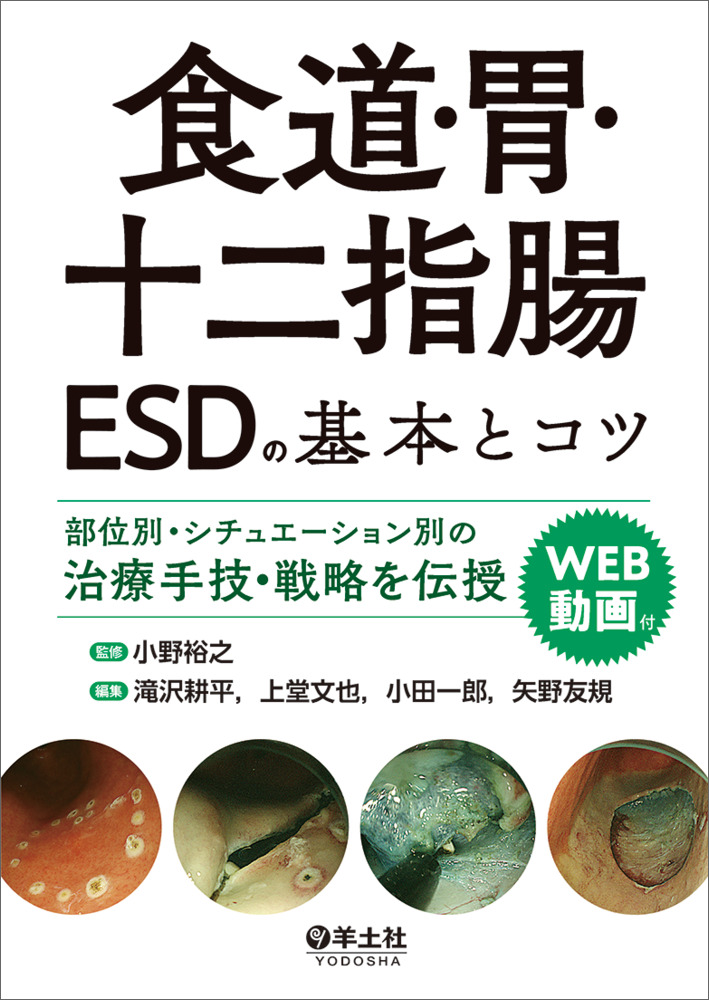 食道・胃・十二指腸 ESDの基本とコツ | 神陵文庫