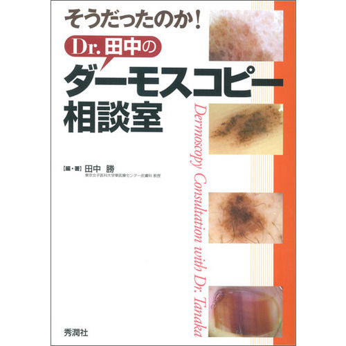 Dr.田中のダーモスコピー相談室 | 神陵文庫