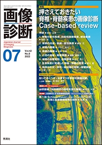 脊椎の画像診断 画像診断 2022年7月 脊椎・脊髄疾患の画像診断Case-based review