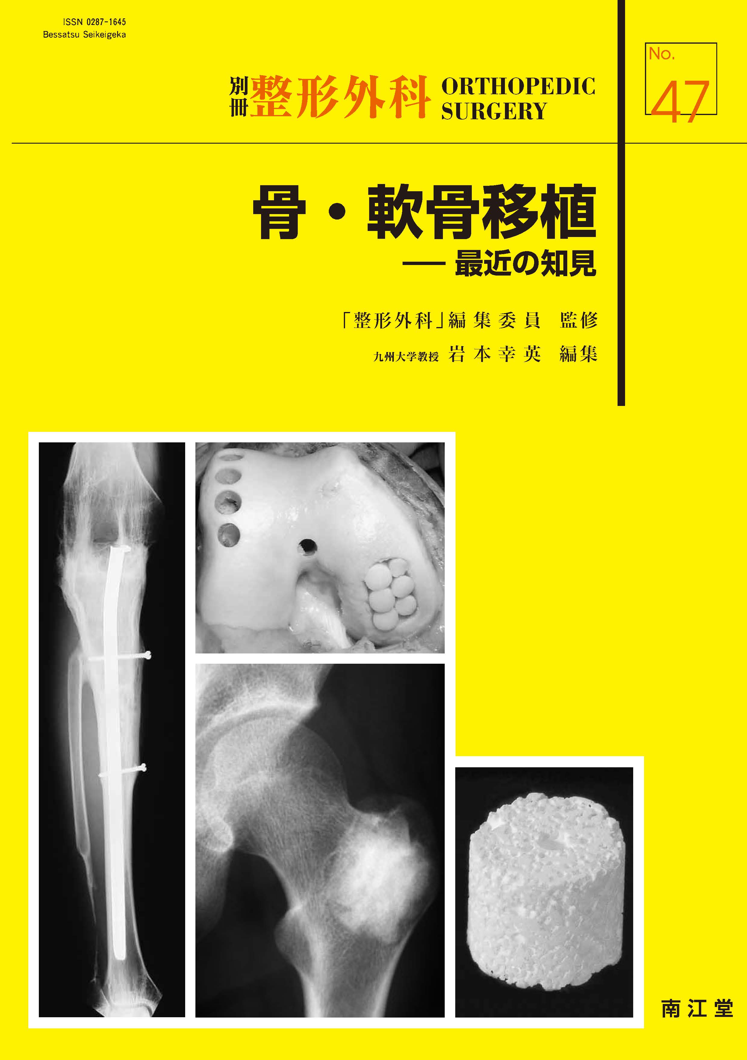 図説　整骨学 1巻2巻　南江堂 別冊 整形外科 47 骨・軟骨移植 | 神陵文庫