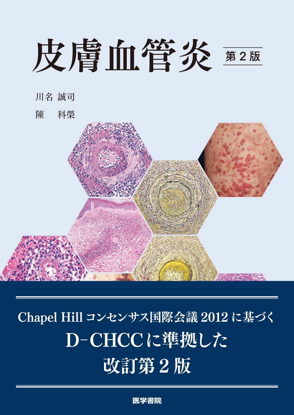 皮膚血管炎 第2版 | 神陵文庫