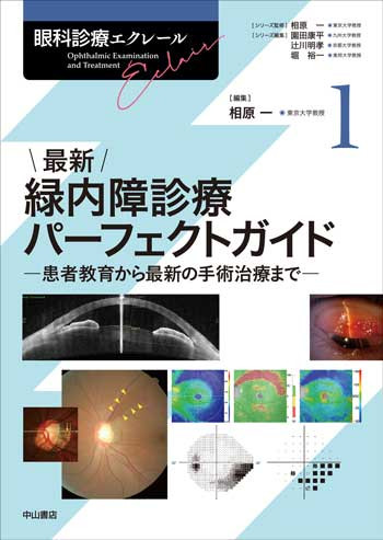 眼科診療エクレール 緑内障診療パーフェクトガイド 眼科診療エクレール 1 最新緑内障診療パーフェクトガイド | 神陵文庫