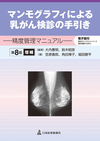 マンモグラフィによる乳がん検診の手引き | 神陵文庫