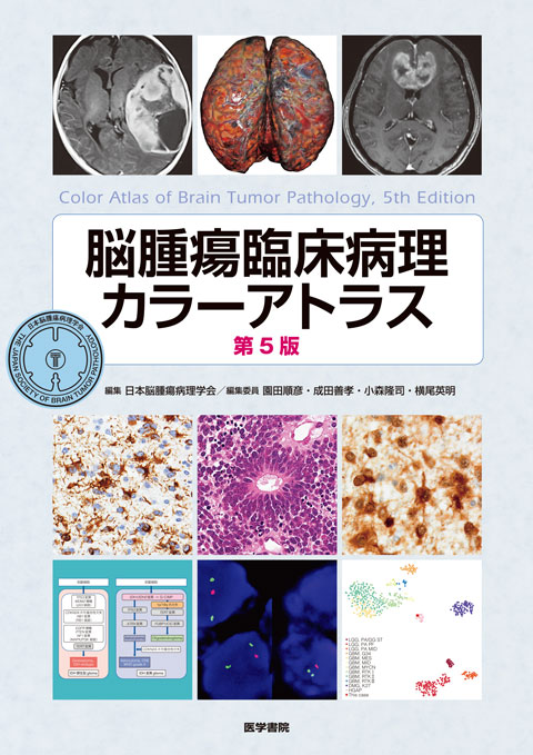 脳腫瘍臨床病理カラーアトラス | 神陵文庫