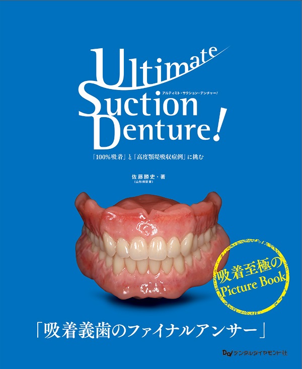 デンタルダイヤモンド　佐藤勝史　Ultimate Suction Denture Ultimate Suction Denture! 「100％吸着」と「高度顎堤吸収症例