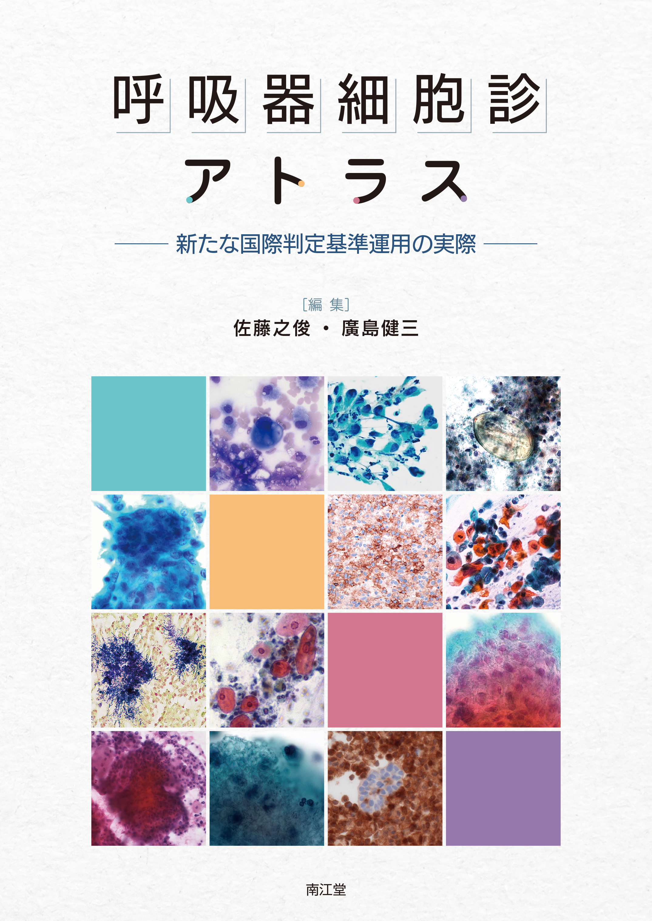 細胞診 鑑別 アトラス Amazon.co.jp: 細胞診鑑別アトラス : 金城 満: 本