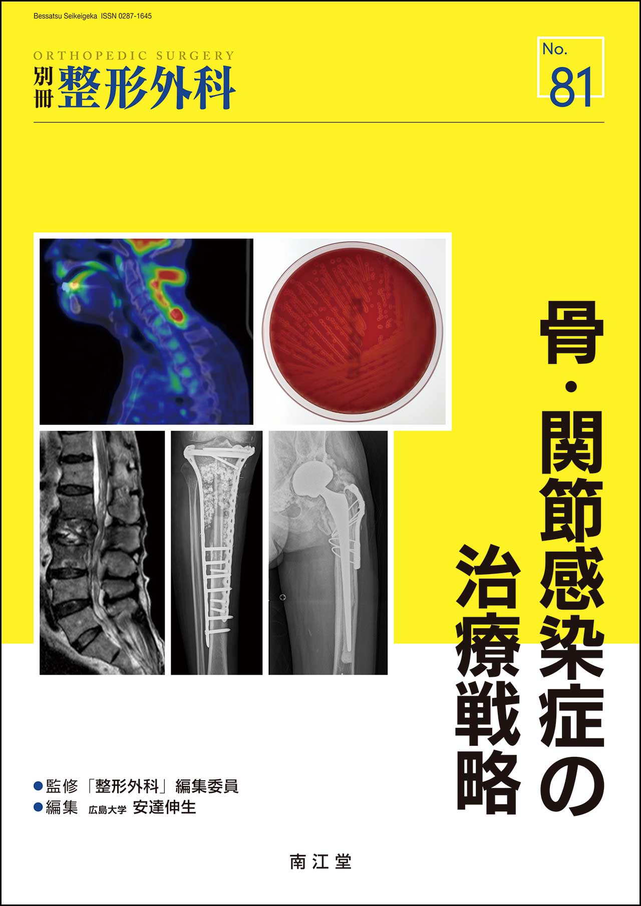 別冊 整形外科 81 骨・関節感染症の治療戦略 | 神陵文庫