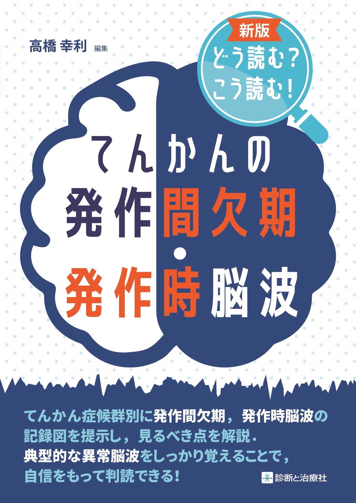 新版どう読む？こう読む！ てんかんの発作間欠期・発作時脳波 | 神陵文庫