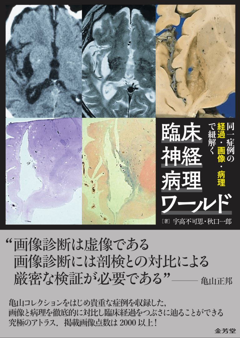 同一症例の経過・画像・病理で紐解く 臨床神経病理ワールド | 神陵文庫