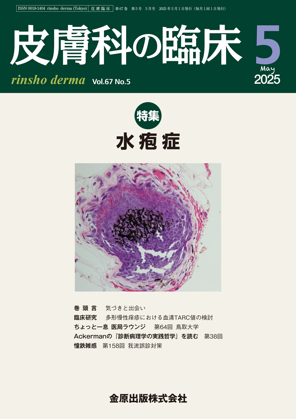 皮膚科の臨床 2025年5月 水疱症(Vol.67 No. 5) | 神陵文庫 皮膚科の臨床 2025年5月 水疱症(Vol.67 No. 5) | 神陵文庫