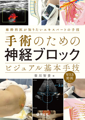 手術のための神経ブロック ビジュアル基本手技**羊土社/笹川 智貴/978-4-7581-1127-0/9784758111270**