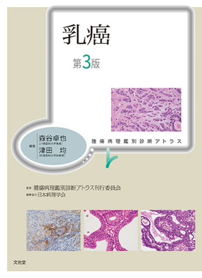 腫瘍病理鑑別診断アトラス 乳癌 第3版**文光堂/森谷 卓也/978-4-8306-2262-5/9784830622625**