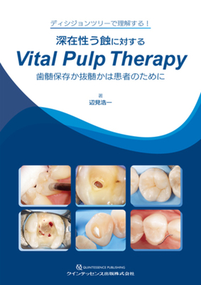 深在性う蝕に対する Vital Pulp Therapy**クインテッセンス出版/辺見　浩一/978-4-7812-1142-8/9784781211428**