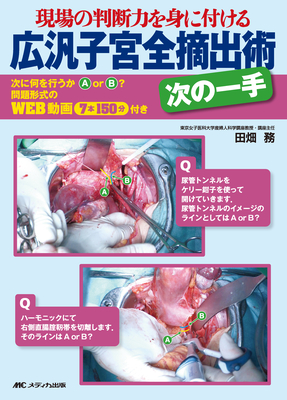 現場の判断力を身に付ける広汎子宮全摘出術 次の一手**メディカ出版/田畑 務/978-4-8404-8489-3/9784840484893**
