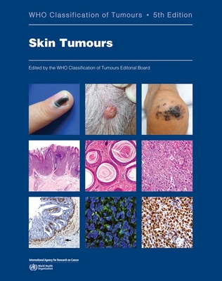 WHO Classification of Tumours 5E. Vol.12: Skin Tumours**WHO/978-92-832-4535-3/9789283245353**