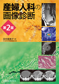 産婦人科の画像診断　第２版**金原出版/田中　優美子/978-4-307-07135-2/9784307071352**