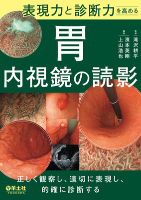 表現力と診断力を高める 胃内視鏡の読影**羊土社/滝沢 耕平/9784758110877**