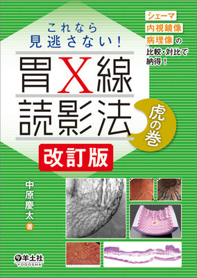 これなら見逃さない！ 胃Ｘ線読影法虎の巻　改訂版**羊土社/中原 慶太/978-4-7581-1086-0/9784758110860**