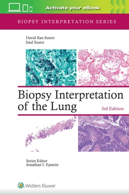 Biopsy Interpretation of the Lung 3E.**Wolters Kluwer/Jonathan I.Epst/9781975240677**