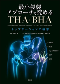 最小侵襲アプローチで究める　THA・BHA**南江堂/西脇　徹/978-4-524-21069-5/9784524210695**