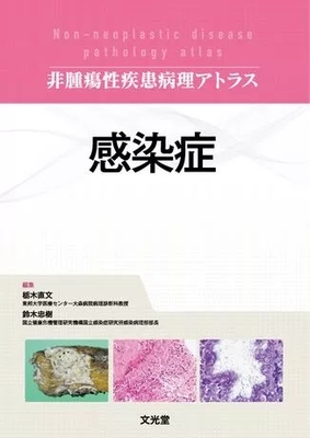 非腫瘍性疾患病理アトラス　感染症**文光堂/栃木　直文/978-4-8306-0701-1/9784830607011**