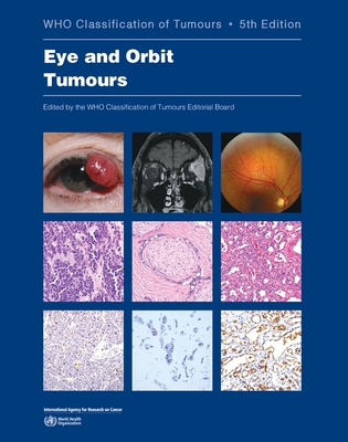 WHO Classification of Tumours, 5E., Vol.13: Eye and Orbit Tumours**WHO/9789283245469**