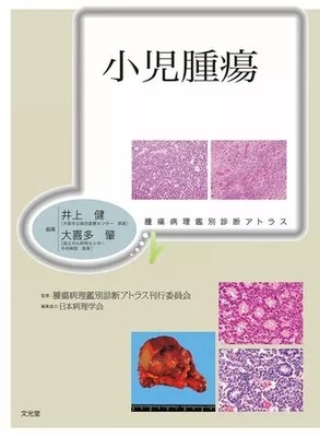 腫瘍病理鑑別診断アトラス　小児腫瘍**文光堂/井上　健/978-4-8306-2272-4/9784830622724**