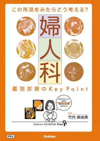 婦人科 鑑別診断の Key Point | 神陵文庫