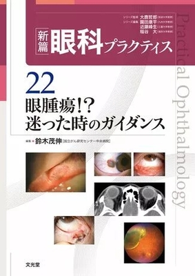 新篇 眼科プラクティス 22 眼腫瘍！？　迷った時のガイダンス**文光堂/鈴木　茂伸/978-4-8306-5637-8/9784830656378**