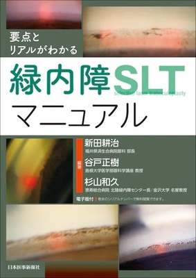 要点とリアルがわかる　緑内障SLTマニュアル**日本医事新報社/新田　耕治/978-4-7849-0275-0/9784784902750**