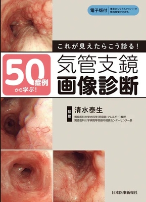 50症例から学ぶ！これが見えたらこう診る！気管支鏡画像診断**日本医事新報社/清水 泰生/978-4-7849-0255-2/9784784902552**