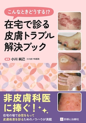 こんなときどうする！？在宅で診る皮膚トラブル解決ブック**診断と治療社/小川 純己/978-4-7878-2737-1/9784787827371**