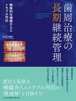 歯周治療の長期継続管理**デンタルダイヤモンド社/谷口 崇拓/978-4-88510-657-6/9784885106576**
