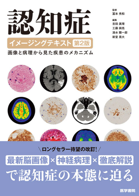 認知症イメージングテキスト 第2版**医学書院/冨本 秀和/978-4-260-06538-2/9784260065382**