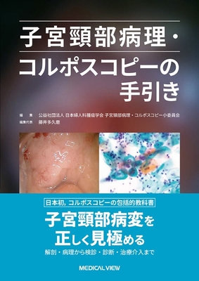 子宮頸部病理・コルポスコピーの手引き**メジカルビュー社/日本婦人科腫瘍学会/978-4-7583-2145-7/9784758321457**