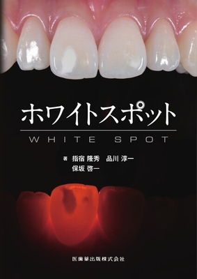ホワイトスポット**医歯薬出版/指宿 隆秀/978-4-263-44772-7/9784263447727**