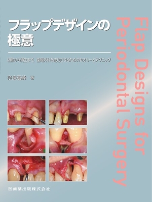 フラップデザインの極意**医歯薬出版/奈良 嘉峰/78-4-263-44764-2/9784263447642**
