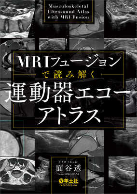 MRIフェージョンで読み解く　運動器エコーアトラス**羊土社/面谷　透/978-4-7581-1271-0/9784758112710**