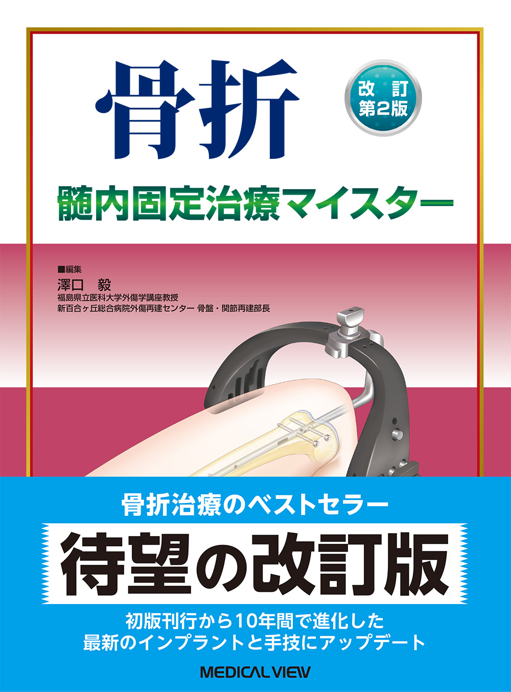 骨折 髄内固定治療マイスター | 神陵文庫