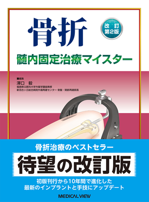 骨折　髄内固定治療マイスター 改訂第2版**メジカルビュー社/澤口 毅/978-4-7583-2323-9/9784758323239**