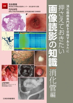 押さえておきたい画像読影の知識　消化管編**日本医事新報社/吉永 繁高/978-4-7849-0544-7/9784784905447**