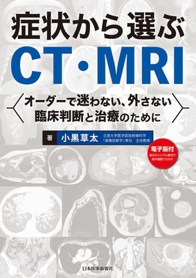 症状から選ぶCT・MRI**日本医事新報社/小黒 草太/978-4-7849-1410-4/9784784914104**